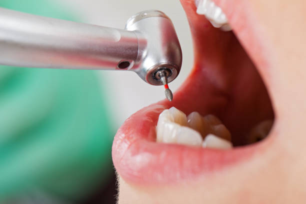 Best Emergency Dental Care for Broken or Chipped Teeth in Throop, PA